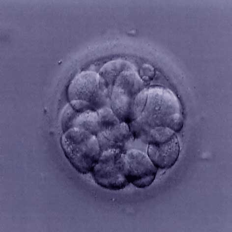 morula